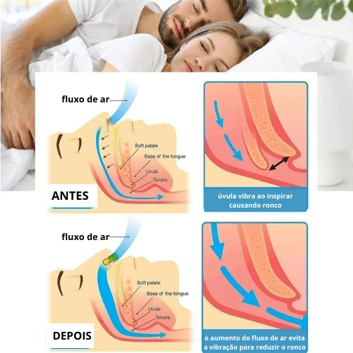 Corretor anti ronco - Dispositivo Magnético pro max